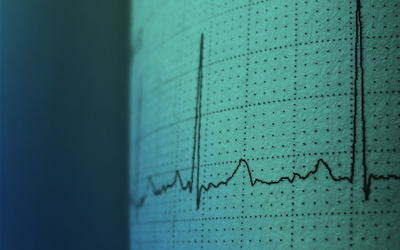 Earthquake monitoring blog post thumbnail